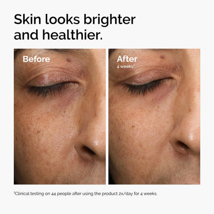 The Ordinary Multi-Antioxidant Radiance Serum, Vitamin C Serum for Face, Brighten & Protect Skin – Boosts Glow & Shields against Environmental Stressors, 1 Fl Oz